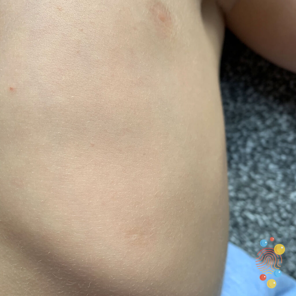 Accessory Nipple