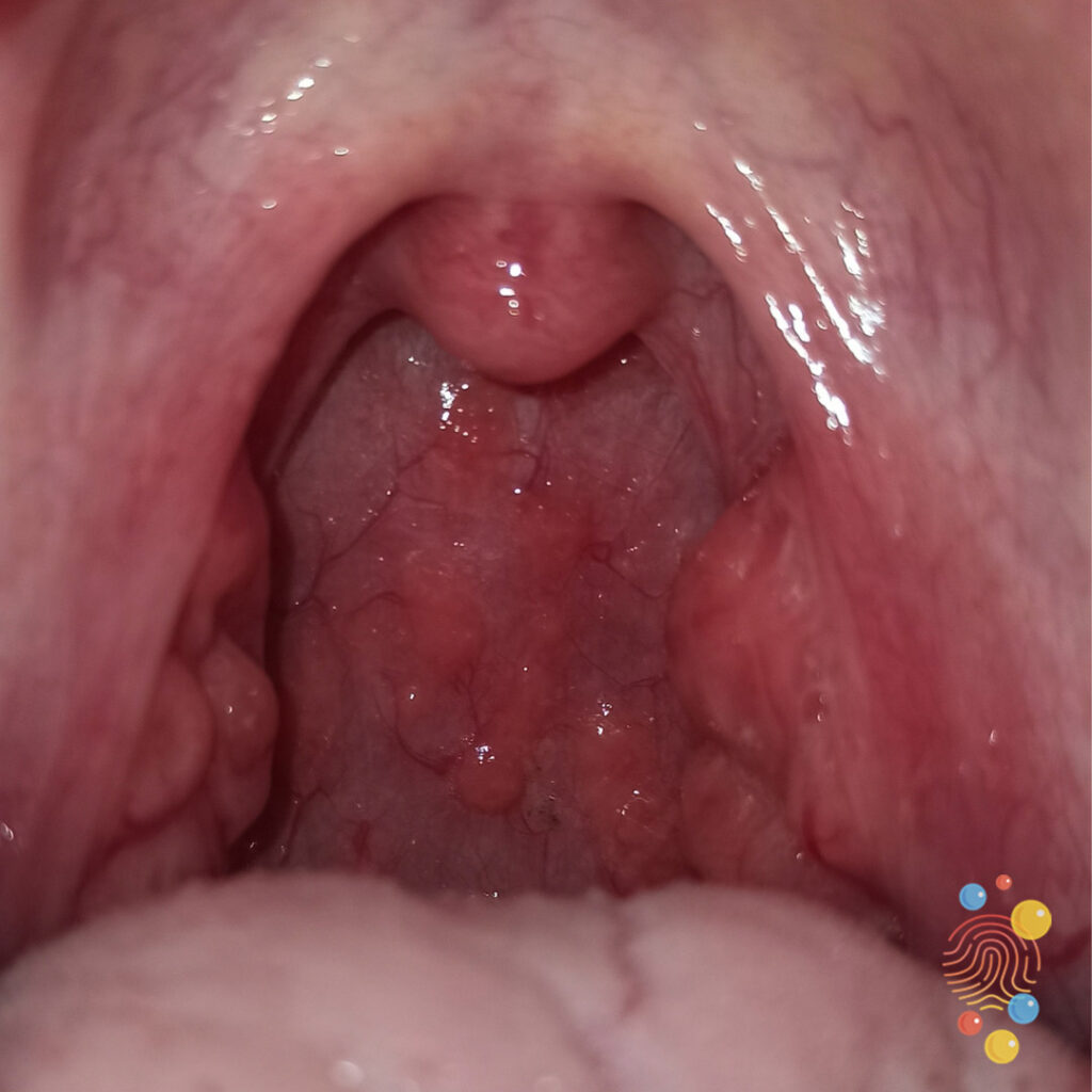 Throat